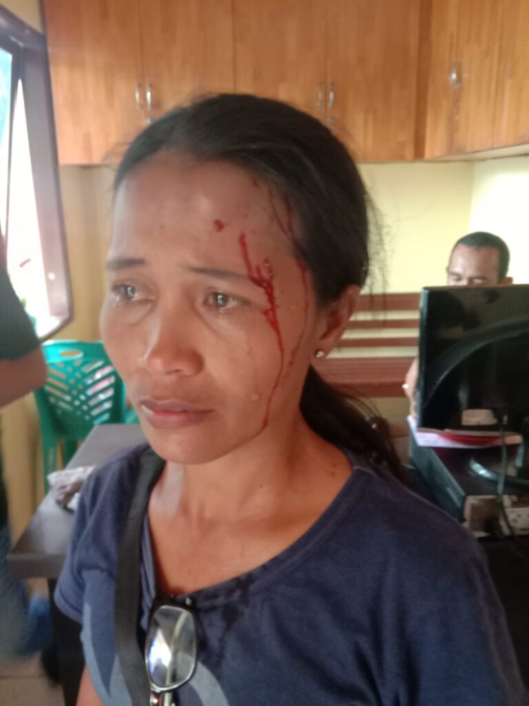 Seorang Perempuan Ditanjung Pinggir Lebam dan Koyak Pada Kening di Hantam Gelas