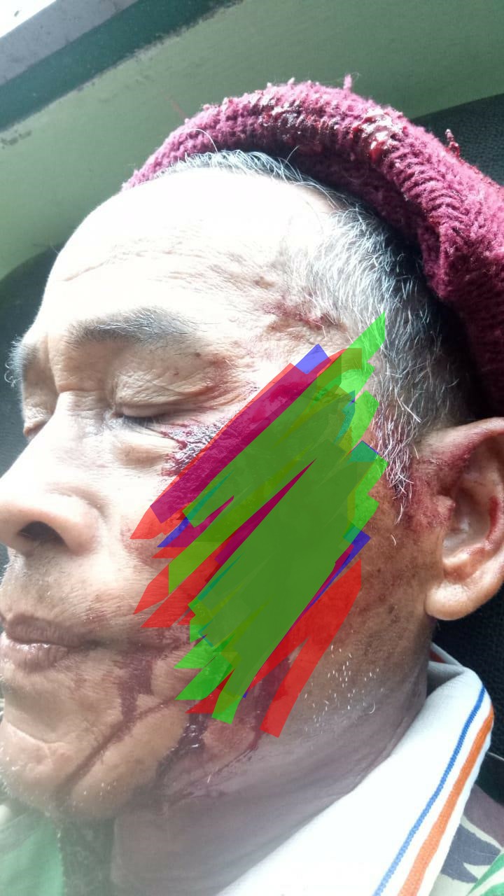 Laporan Masyarakat Adat Natumingka Mengendap Di Polda Sumut Dan Polres Toba